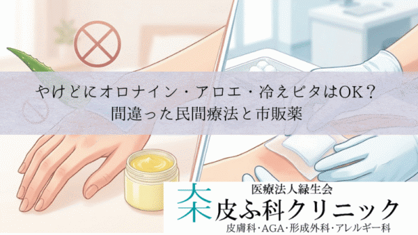 やけどにオロナイン・アロエ・冷えピタはOK？｜間違った民間療法と市販薬