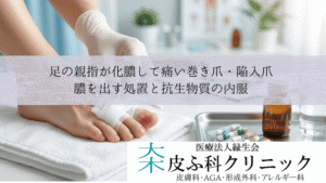 足の親指が化膿して痛い巻き爪・陥入爪｜膿を出す処置と抗生物質の内服