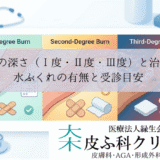 やけどの深さ（Ⅰ度・Ⅱ度・Ⅲ度）と治る期間｜水ぶくれの有無と受診目安