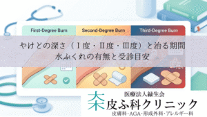 やけどの深さ（Ⅰ度・Ⅱ度・Ⅲ度）と治る期間｜水ぶくれの有無と受診目安