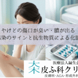 やけどの傷口が臭い・膿が出る｜細菌感染のサインと抗生物質による化膿止め