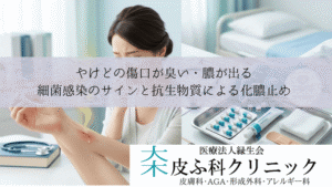 やけどの傷口が臭い・膿が出る|細菌感染のサインと抗生物質による化膿止め