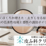 急にほくろが増えた・大きくなる原因｜良性の色素性母斑と悪性の識別ポイント