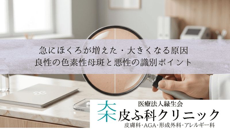 急にほくろが増えた・大きくなる原因｜良性の色素性母斑と悪性の識別ポイント
