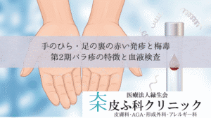 手のひら・足の裏の赤い発疹と梅毒｜第2期バラ疹の特徴と血液検査