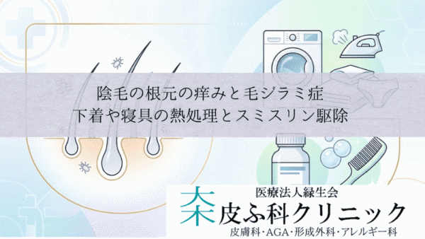 陰毛の根元の痒みと毛ジラミ症｜下着や寝具の熱処理とスミスリン駆除