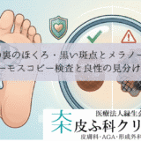 足の裏のほくろ・黒い斑点とメラノーマ｜ダーモスコピー検査と良性の見分け方
