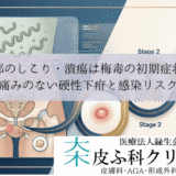 陰部のしこり・潰瘍は梅毒の初期症状？｜痛みのない硬性下疳と感染リスク