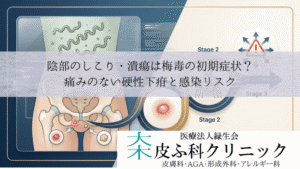 陰部のしこり・潰瘍は梅毒の初期症状？｜痛みのない硬性下疳と感染リスク