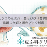 鼻の入り口のただれ・鼻とびひ（鼻前庭炎）｜鼻ほじり癖と黄色ブドウ球菌