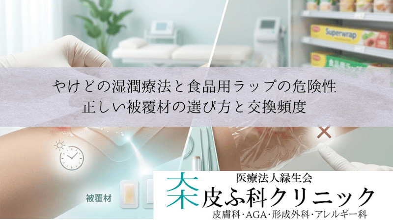 やけどの湿潤療法と食品用ラップの危険性|正しい被覆材の選び方と交換頻度