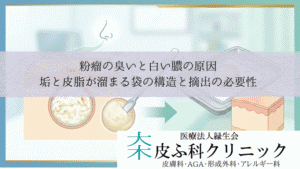 粉瘤の臭いと白い膿の原因｜垢と皮脂が溜まる袋の構造と摘出の必要性