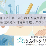 粉瘤（アテローム）のくり抜き法手術｜傷跡が目立たない日帰り治療とダウンタイム