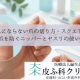 巻き爪にならない爪の切り方・スクエアオフ｜深爪を防ぐニッパーとヤスリの使い方