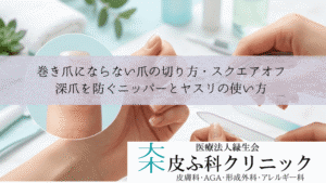 巻き爪にならない爪の切り方・スクエアオフ|深爪を防ぐニッパーとヤスリの使い方