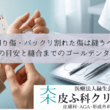 深い切り傷・パックリ割れた傷は縫うべき？｜受診の目安と縫合までのゴールデンタイム