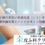 やけど跡の茶色い色素沈着（シミ）を消す｜紫外線対策とハイドロキノン治療