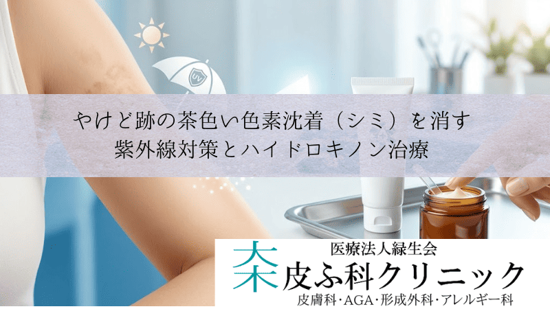 やけど跡の茶色い色素沈着（シミ）を消す｜紫外線対策とハイドロキノン治療