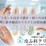 ガングリオンを自分で潰す・叩くのは危険？｜押し潰す療法のリスクと自然治癒