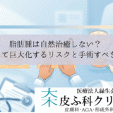 脂肪腫は自然治癒しない？｜放置して巨大化するリスクと手術すべき時期