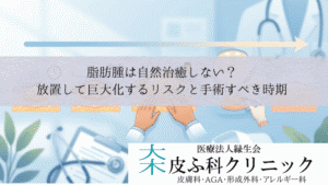 脂肪腫は自然治癒しない？｜放置して巨大化するリスクと手術すべき時期