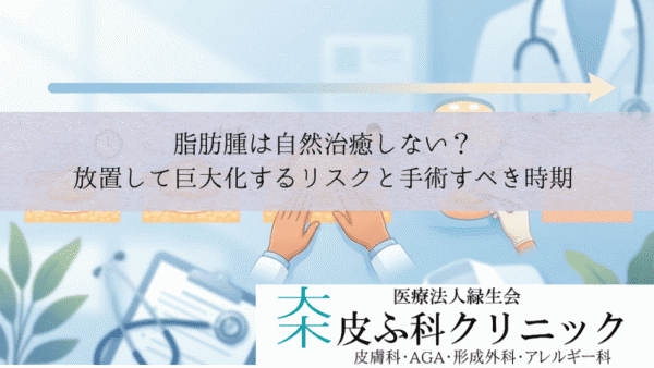 脂肪腫は自然治癒しない？｜放置して巨大化するリスクと手術すべき時期