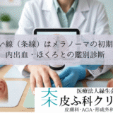 爪の黒い線（条線）はメラノーマの初期症状？｜内出血・ほくろとの鑑別診断