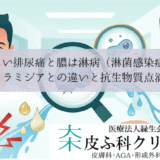 激しい排尿痛と膿は淋病（淋菌感染症）｜クラミジアとの違いと抗生物質点滴