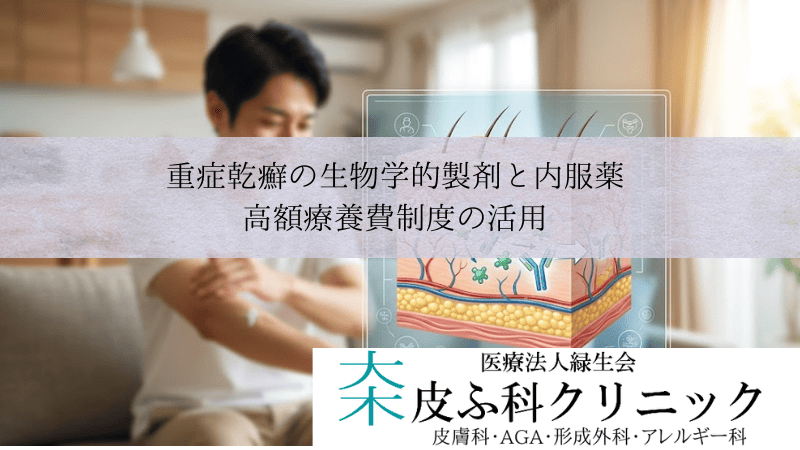 重症乾癬の生物学的製剤（注射）と内服薬（オテズラ）｜高額療養費制度の活用