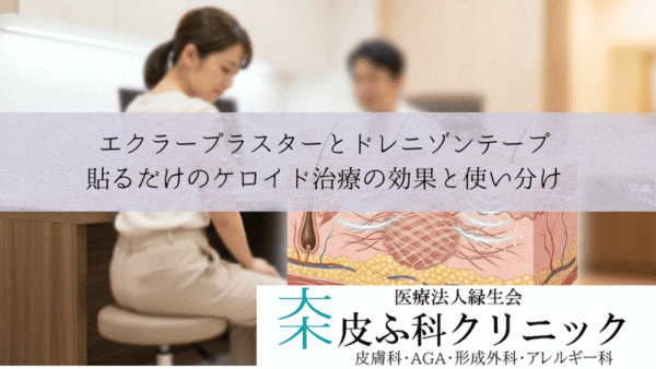 エクラープラスターとドレニゾンテープ｜貼るだけのケロイド治療の効果と使い分け