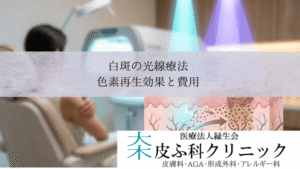 白斑の光線療法・エキシマライトとナローバンドUVB｜色素再生効果と費用