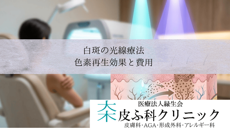 白斑の光線療法・エキシマライトとナローバンドUVB|色素再生効果と費用