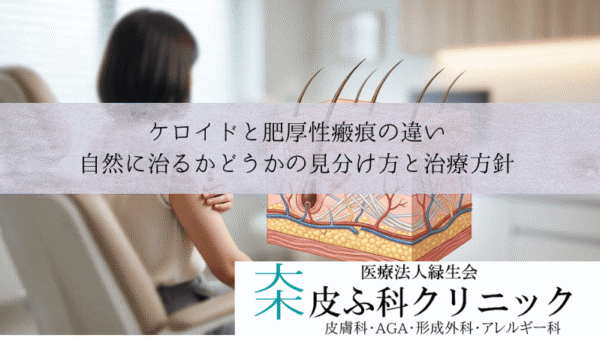 ケロイドと肥厚性瘢痕の違い｜自然に治るかどうかの見分け方と治療方針