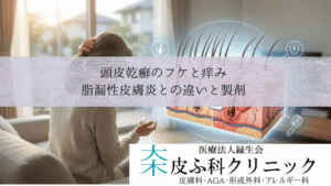 頭皮乾癬のフケと痒み|脂漏性皮膚炎との違いとローション・シャンプー製剤