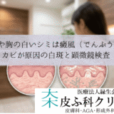 背中や胸の白いシミは癜風（でんぷう）？｜カビが原因の白斑と顕微鏡検査