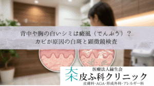背中や胸の白いシミは癜風（でんぷう）？｜カビが原因の白斑と顕微鏡検査