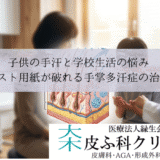 子供の手汗と学校生活の悩み｜テスト用紙が破れる手掌多汗症の治療
