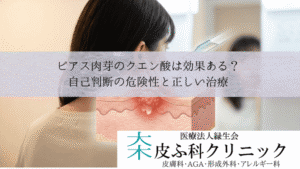 ピアス肉芽のクエン酸・ホットソークは効果ある？｜自己判断の危険性と正しい治療