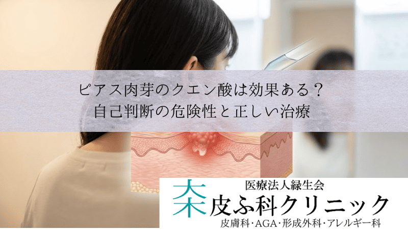 ピアス肉芽のクエン酸・ホットソークは効果ある？｜自己判断の危険性と正しい治療