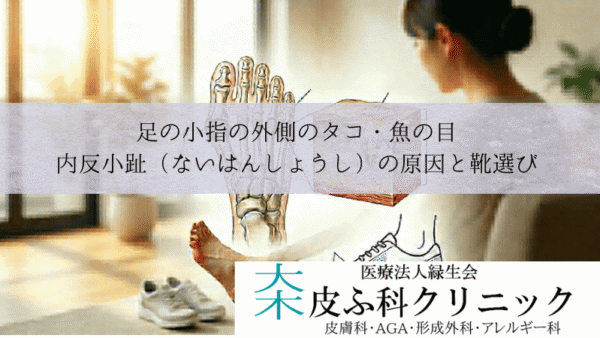 足の小指の外側のタコ・魚の目|内反小趾(ないはんしょうし)の原因と靴選び