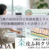 尋常性白斑の原因は自己免疫疾患とストレス？｜甲状腺機能障害との合併リスク