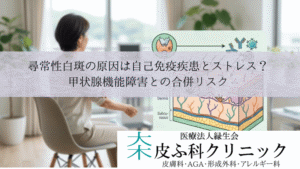 尋常性白斑の原因は自己免疫疾患とストレス?|甲状腺機能障害との合併リスク