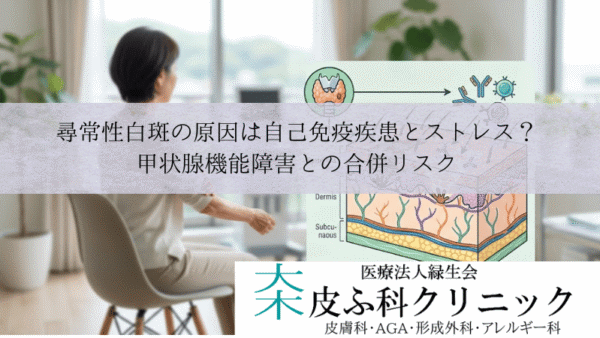 尋常性白斑の原因は自己免疫疾患とストレス？｜甲状腺機能障害との合併リスク