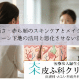 酒さ・赤ら顔のスキンケアとメイク｜グリーン下地の活用と悪化させない洗顔