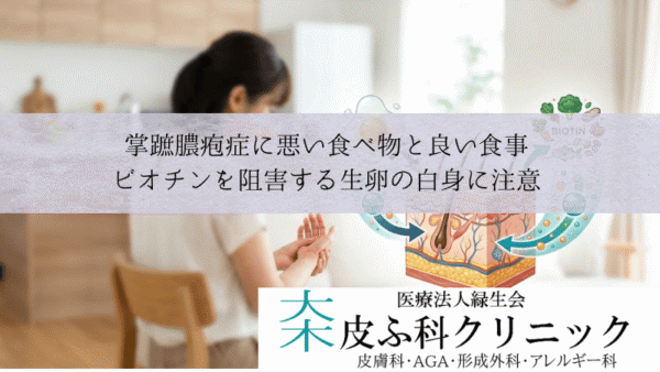 掌蹠膿疱症 | 大木皮ふ科クリニック｜相模大野駅徒歩1分