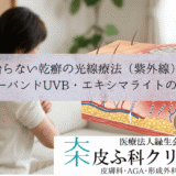治らない乾癬の光線療法（紫外線）｜ナローバンドUVB・エキシマライトの費用
