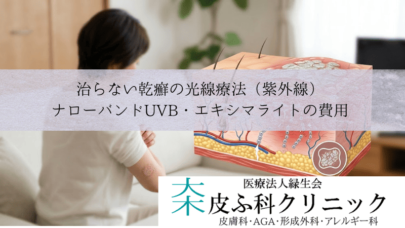 治らない乾癬の光線療法（紫外線）｜ナローバンドUVB・エキシマライトの費用