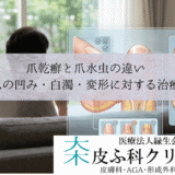 爪乾癬と爪水虫の違い｜爪の凹み・白濁・変形に対する皮膚科治療