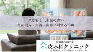 爪乾癬と爪水虫の違い|爪の凹み・白濁・変形に対する皮膚科治療