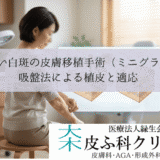 治らない白斑の皮膚移植手術（ミニグラフト）｜吸盤法による植皮と適応